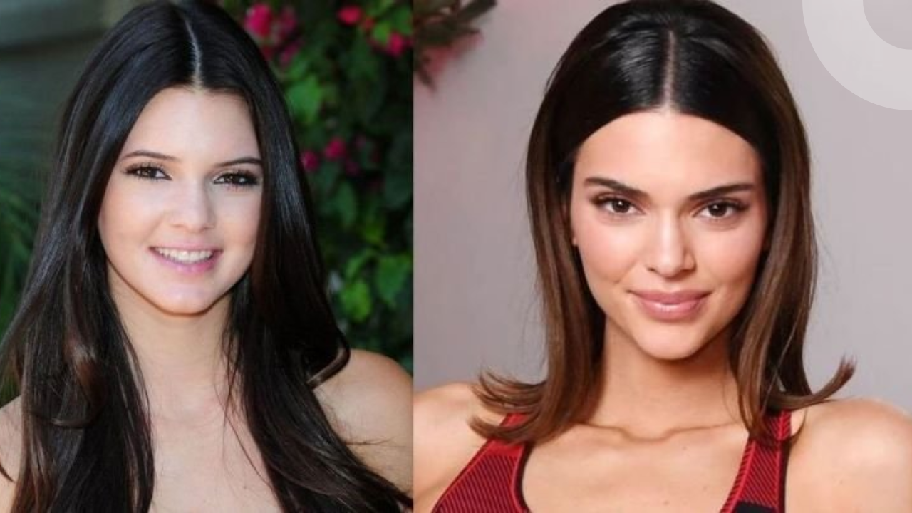 kendall jenner before surgery