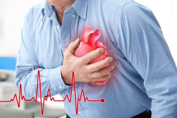 What to Do in Case of Heart Attack
