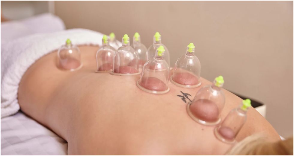 Exploring the Benefits of Learning Hijama Therapy in Sydney