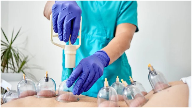 Understanding Hijama Therapy